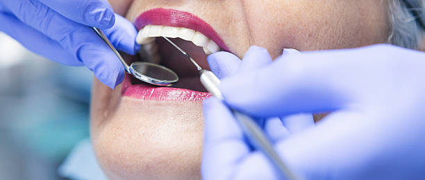 Best Emergency Dentist for Lost Fillings or Crowns in Morada, CA